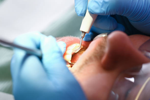 Best Tooth Infection Emergency Dentist  in Iowa City, IA